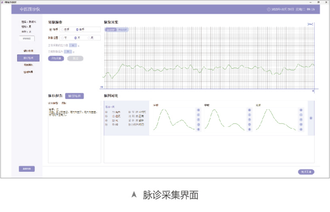 中医四诊仪02型（舌面脉信息采集管理系统）MT-SMT-02脉诊采集界面.png